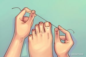 Tips Mengatasi Kuku Jari yang Tumbuh ke Dalam Daging