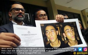 Jeremy Thomas Tak Terima Anaknya Dianiaya Oknum Polisi