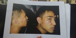 Anak Jeremy Thomas Hendak ke Singapura untuk Berobat, Tapi…