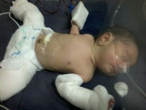 Aneh! Bayi Ini Ditemukan Hamil Sesaat Setelah Dilahirkan, Kok Bisa?