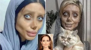 Operasi Plastik 50 Kali, Gadis Ini Justru Mirip Zombie Ketimbang Angelina Jolie