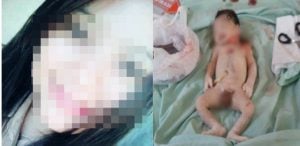 Sadis! Usai Melahirkan, Siswi SMK Ini Tusuk Bayinya 11 Kali dengan Gunting