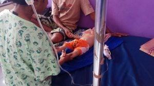 Minum Air Panas, Bibir dan Pipi Bayi Ini Melepuh