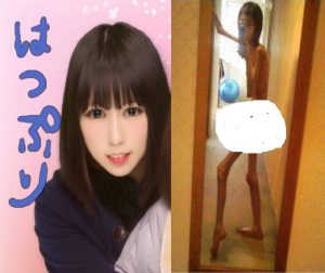 Kakek Larang Makan, Gadis Jepang Mirip Tengkorak Hidup