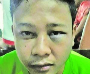 Dikeroyok, Wajah Guru ini Bonyok, Gigi Atas Patah