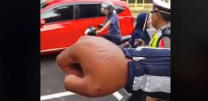 Tak Terima Ditilang, Emak-emak Gigit Tangan Polisi