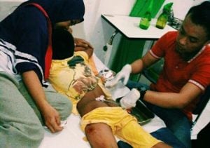 Bocah 8 Tahun Lolos dari Gigitan Buaya, Pinggang dan Paha Robek