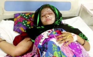 Kecewa Bayinya Perempuan, Suami Siram Wajah Istri dengan Air Keras
