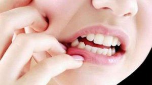 Jangan Sepelekan Sariawan di Lidah, Bisa Jadi Gejala Awal Kanker