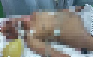 Diserang Parang dan Tombak, 4 Korban Pesta Miras Bersimbah Darah