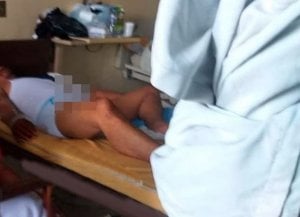 Ereksi Selama Tiga Hari, Berakhir di Rumah Sakit