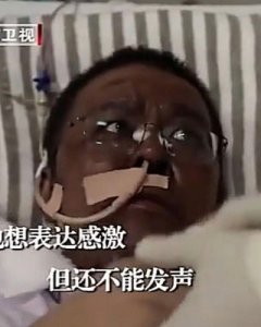 Bukan Hoaks, 2 Dokter di Tiongkok Berubah Hitam Terinfeksi Virus Corona