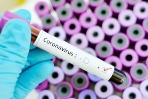 Penularan Covid-19 di Atas 60 Persen Berasal dari OTG