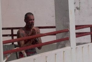 Pria Bertato Dorong Istri dari Balkon Lantai 7, Ini Kondisi Sukanda