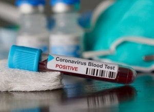 Update COVID-19, Tambah 395 Kasus Baru dalam Sehari