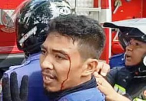 Sudah Ditolong, Petugas Damkar Malah Terluka Kena Pukulan Warga