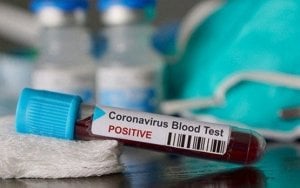 Rekor Baru, Kasus Harian Covid-19 di Indonesia Tembus 4.176