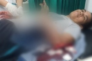 Begitu Rumah Dibuka, 3 Pemuda Saling Bacok dan Semuanya Bersimbah Darah