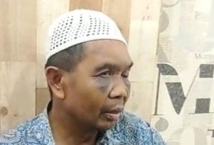 Saksi Diduga Disiksa Oknum Polisi, Dipaksa Mengaku Sebagai Pelaku Pembunuhan