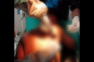 Asyik Berbincang di Pinggir Jalan, 2 Pelajar Tiba-tiba Ditikam dan Dipanah