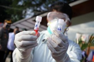 Tes Swab Tahap Ketiga Berakhir, Diskes Makassar Periksa 746 Sampel