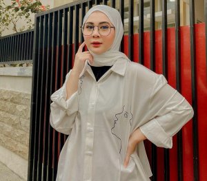 Dituding Suntik Putih, Kesha Ratuliu: Aku Memang Bule