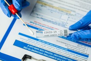Antisipasi Lonjakan Covid-19 di Sulsel, 10 Pos Lakukan Pemeriksaan Antigen