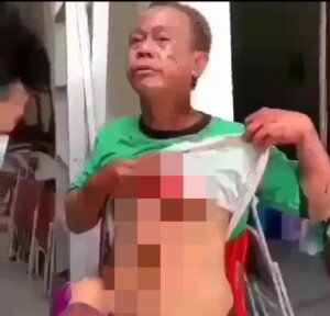 Kondisi Terkini Kosmas, Satpam yang Gagalkan Bomber Masuk ke Gereja Katedral Makassar
