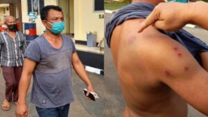 Ditembak 10 Kali Oleh Begal! Sopir Taksi Ini Berhasil Selamat, Ini yang Ia Lakukan