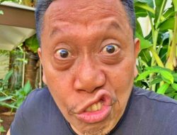 Disarankan dr Terawan, Tukul Arwana Disuntik Vaksin Nusantara, Kondisinya Begini…