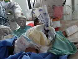 Anak Perempuan Lahir Tanpa Dinding Perut, Kemensos Gerak Cepat Berikan Bantuan, Namun Kehendak Tuhan Lain