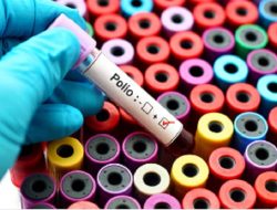 Ahli Ungkap Lalat dan Kecoa Jadi Pembawa Virus Polio