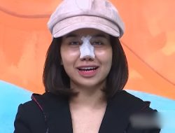 Mayang Adik Vanessa Angel Operasi Hidung Supaya Banyak Rezeki, Netizen: Ajaran dari Mana?