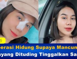 Operasi Hidung Supaya Mancung, Mayang Dituding Tinggalkan Salat