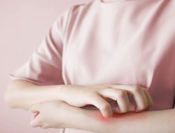 Hati-hati! Scabies Bisa Menular dan Sebabkan Komplikasi, Ini Cara Mengobatinya