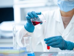 Mengenal Virus Marburg, Sedang Mewabah di Afrika dengan Tingkat Kematian hingga 88 Persen