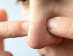 Tips Efektif untuk Menghilangkan Pori-Pori Hidung yang Membesar