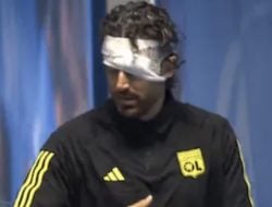 Fans Marseille Lempari Bus Lyon, Pelatih Fabio Grosso Luka Serius di Wajah