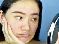 Tips Memperbaiki Skin Barrier Wajah, Kunci Kulit Sehat dan Glowing