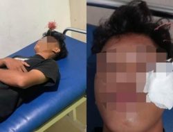 Busur Salah Sasaran, Pemuda di Makassar Jadi Korban Kejamnya Jalanan