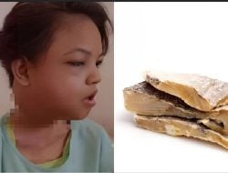 Benarkah Ikan Asin Picu Kanker Nasofaring? Berikut Faktanya