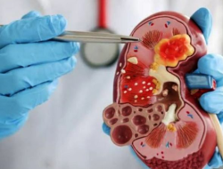 Diabetes dan Hipertensi Bisa Jadi Peringatan Dini Gagal Ginjal