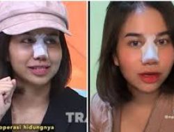 Mayang Lucyana Bangga Sudah Oplas, Netizen Ramai Bandingkan dengan Fuji
